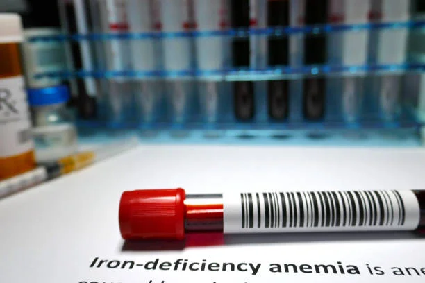 Iron-deficiency Anemia in Pregnancy Causes, Prevention & Treatment