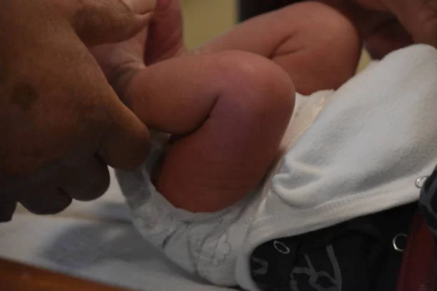 The Circumcision Debate: Should you opt to have your son go through with it?